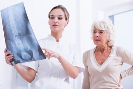 Doktor ukazuje pacientovi x -ray obrázek páteře