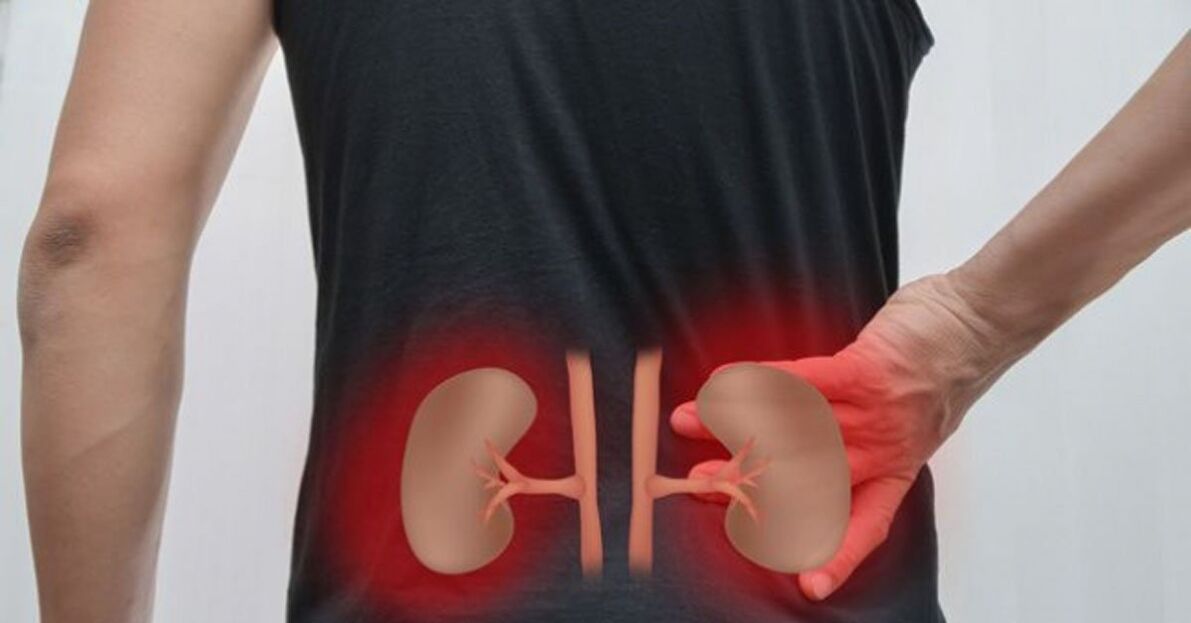 onemocnění ledvin jako příčina bolesti dolní části zad