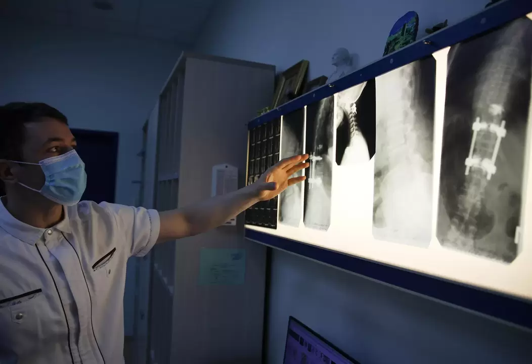 Lékaři diagnostikují cervikální osteochondrózu pomocí instrumentálních metod, jako je radiografie
