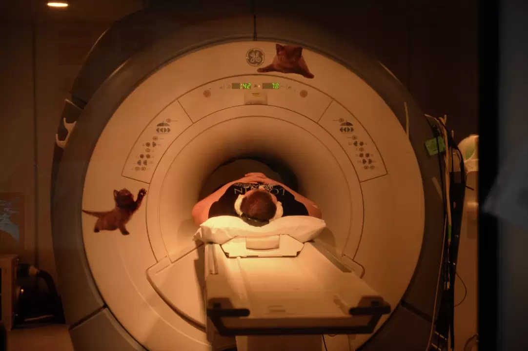Magnetická rezonance je nejúčinnější metodou pro diagnostiku cervikální osteochondrózy